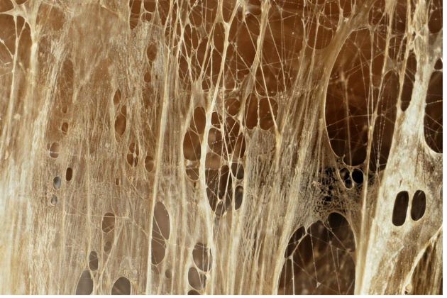 Fascial tissue under magnification showing the weblike network