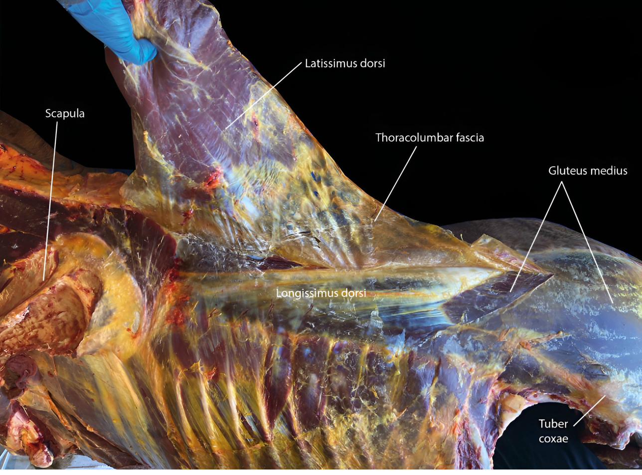 Fascia research underpinning chronic pain treatment in Bath and Bristol