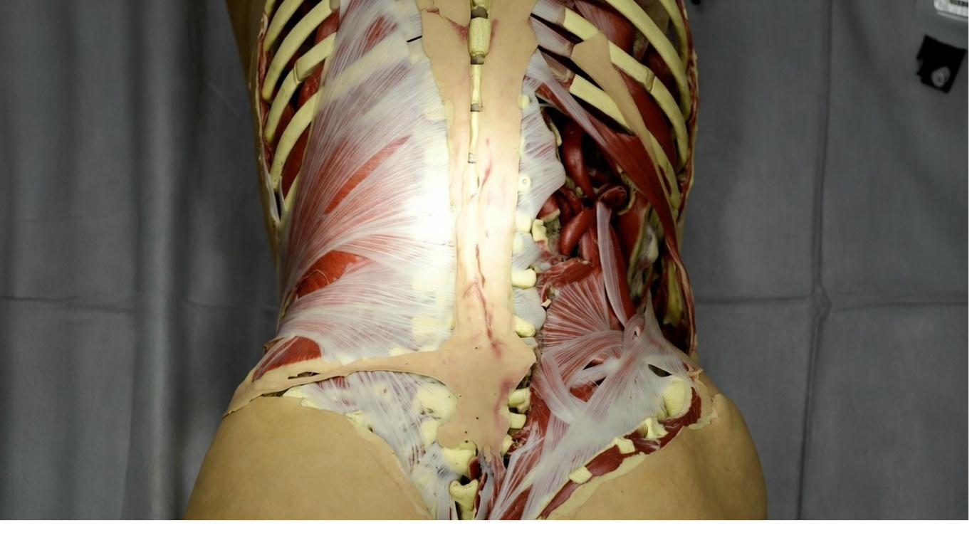 Fascia mechanical restriction causing Fibromyalgia pain - Physology Bath Bristol