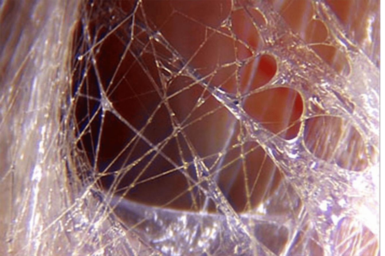 Myofascial release technique at Physology Bath showing Fascial tissue being worked on