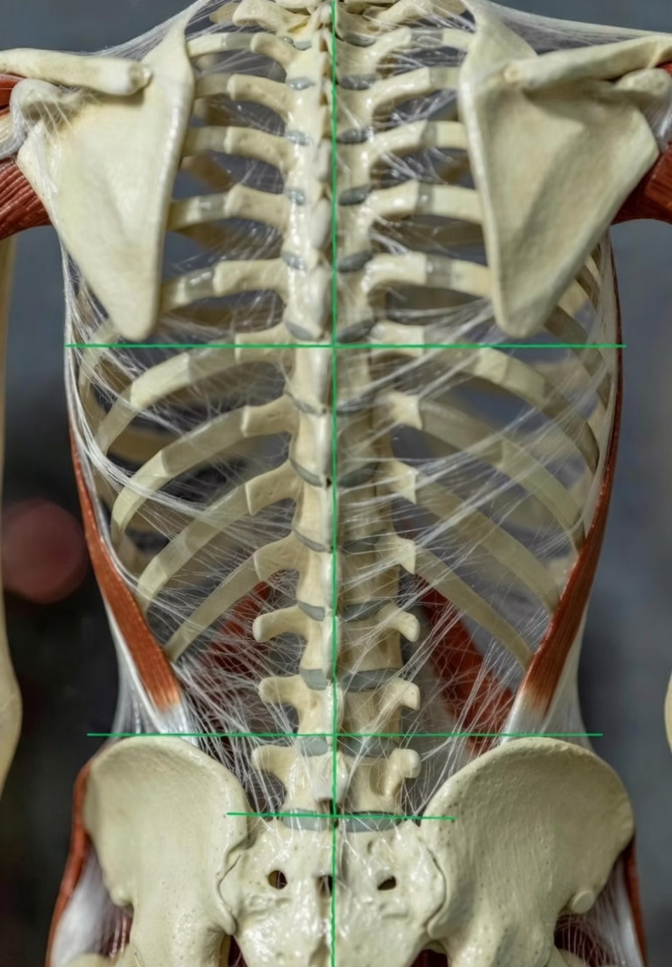 Skeletal realignment through fascial balance